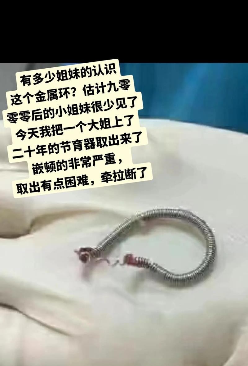 《圆环无敌，我来挑战》（用游戏技巧）